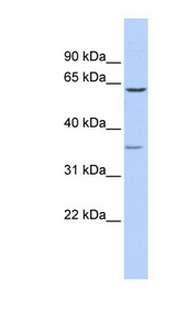 GBAS Antibody - GBAS antibody Western blot of THP-1 cell lysate. This image was taken for the unconjugated form of this product. Other forms have not been tested.