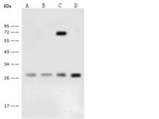 GBAS Antibody - Anti-GBAS rabbit polyclonal antibody at 1:500 dilution. Lane A: THP1 Whole Cell Lysate. Lane B: A549 Whole Cell Lysate. Lane C: H1299 Whole Cell Lysate. Lane D: HCT116 Whole Cell Lysate. Lysates/proteins at 30 ug per lane. Secondary: Goat Anti-Rabbit IgG (H+L)/HRP at 1/10000 dilution. Developed using the ECL technique. Performed under reducing conditions. Predicted band size: 34 kDa. Observed band size: 28 kDa.