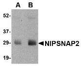 GBAS Antibody - Western blot of NIPSNAP2 in human skeletal muscle tissue lysate with NIPSNAP2 antibody at (A) 0.5 and (B) 1 ug/ml