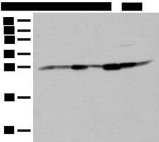 GBAS Antibody - Western blot analysis of Hela HT-29 and HEPG2 cell Human liver tissue Human fetal liver tissue Mouse liver tissue and Human fetal brain tissue lysates  using NIPSNAP2 Polyclonal Antibody at dilution of 1:400