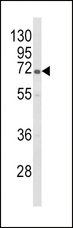 GBE1 Antibody - Western blot of GBE1 Antibody in HL-60 cell line lysates (35 ug/lane). GBE1 (arrow) was detected using the purified antibody;