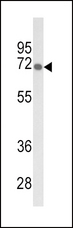 GBE1 Antibody - Western blot of GBE1 Antibody in mouse liver tissue lysates (35 ug/lane). GBE1 (arrow) was detected using the purified antibody.