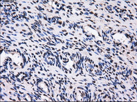 GBE1 Antibody - Immunohistochemical staining of paraffin-embedded Ovary tissue using anti-GBE1 mouse monoclonal antibody. (Dilution 1:50).
