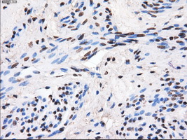 GBE1 Antibody - Immunohistochemical staining of paraffin-embedded endometrium tissue using anti-GBE1 mouse monoclonal antibody. (Dilution 1:50).