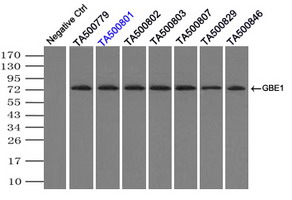 GBE1 Antibody - Immunoprecipitation(IP) of GBE1 by using monoclonal anti-GBE1 antibodies (Negative control: IP without adding anti-GBE1 antibody.). For each experiment, 500ul of DDK tagged GBE1 overexpression lysates (at 1:5 dilution with HEK293T lysate), 2 ug of anti-GBE1 antibody and 20ul (0.1 mg) of goat anti-mouse conjugated magnetic beads were mixed and incubated overnight. After extensive wash to remove any non-specific binding, the immuno-precipitated products were analyzed with rabbit anti-DDK polyclonal antibody.