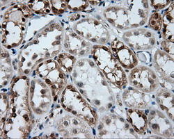 GBE1 Antibody - IHC of paraffin-embedded Kidney tissue using anti-GBE1 mouse monoclonal antibody. (Dilution 1:50).