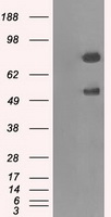 GBE1 Antibody - HEK293T cells were transfected with the pCMV6-ENTRY control (Left lane) or pCMV6-ENTRY GBE1 (Right lane) cDNA for 48 hrs and lysed. Equivalent amounts of cell lysates (5 ug per lane) were separated by SDS-PAGE and immunoblotted with anti-GBE1.