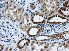 GBE1 Antibody - Immunohistochemical staining of paraffin-embedded Kidney tissue using anti-GBE1 mouse monoclonal antibody. (Dilution 1:50).