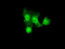 GBE1 Antibody - Anti-GBE1 mouse monoclonal antibody  immunofluorescent staining of COS7 cells transiently transfected by pCMV6-ENTRY GBE1.