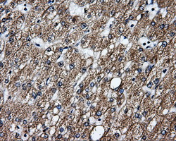 GBE1 Antibody - Immunohistochemical staining of paraffin-embedded liver tissue using anti-GBE1 mouse monoclonal antibody. (Dilution 1:50).