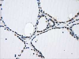 GBE1 Antibody - IHC of paraffin-embedded thyroid tissue using anti-GBE1 mouse monoclonal antibody. (Dilution 1:50).