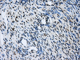 GBE1 Antibody - IHC of paraffin-embedded Ovary tissue using anti-GBE1 mouse monoclonal antibody. (Dilution 1:50).