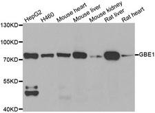 GBE1 Antibody - Western blot analysis of extracts of various cell lines.