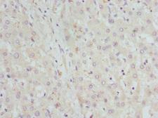 GBE1 Antibody - Immunohistochemistry of paraffin-embedded Human liver tissue at dilution 1:100