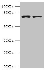 GBE1 Antibody - Western blot All Lanes:GBE1 antibody at 3.13ug/ml Lane 1:HepG2 whole cell lysate Lane 2:Hela whole cell lysate Secondary Goat polyclonal to rabbit at 1/10000 dilution Predicted band size: 80kDa Observed band size: 80kDa