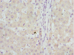 GBE1 Antibody - Immunohistochemistry of paraffin-embedded Human liver tissue at dilution 1:100