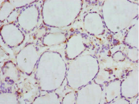 GBE1 Antibody - Immunohistochemistry of paraffin-embedded human thyroid tissue at dilution 1:100