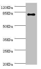 GBE1 Antibody - Western blot All Lanes:GBE1 antibody at 3.13ug/ml+mouse liver tissue Secondary Goat polyclonal to rabbit at 1/10000 dilution Predicted band size 80kDa Observed band size: 80kDa