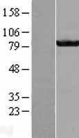 GBE1 Protein - Western validation with an anti-DDK antibody * L: Control HEK293 lysate R: Over-expression lysate