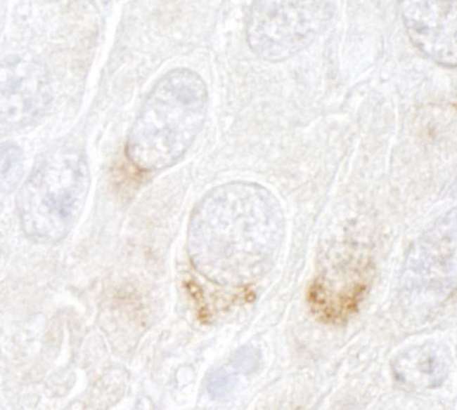 GBF1 Antibody - Detection of Mouse GBF1 by Immunohistochemistry. Sample: FFPE section of mouse squamous cell carcinoma. Antibody: Affinity purified rabbit anti-GBF1 used at a dilution of 1:250.
