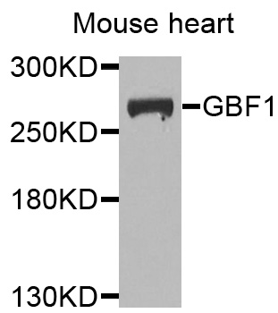 GBF1 Antibody - Western blot analysis of extracts of mouse heart cells.