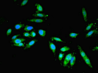 GBF1 Antibody - Immunofluorescent analysis of Hela cells cells diluted at 1:100 and Alexa Fluor 488-congugated AffiniPure Goat Anti-Rabbit IgG(H+L)