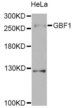 GBF1 Antibody - Western blot analysis of extracts of HeLa cells, using GBF1 Antibody at 1:1000 dilution. The secondary antibody used was an HRP Goat Anti-Rabbit IgG (H+L) at 1:10000 dilution. Lysates were loaded 25ug per lane and 3% nonfat dry milk in TBST was used for blocking. An ECL Kit was used for detection and the exposure time was 90s.