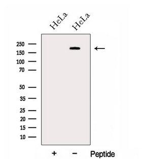 GBF1 Antibody - Western blot analysis of extracts of HeLa cells using GBF1 antibody. The lane on the left was treated with blocking peptide.