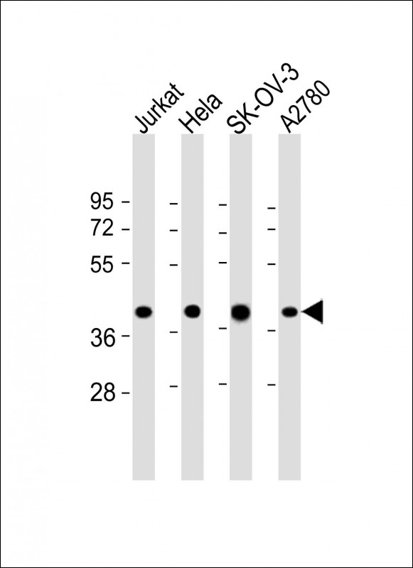 GBGT1 Antibody - All lanes: Anti-GBGT1 Antibody (Center) at 1:2000 dilution Lane 1: Jurkat whole cell lysate Lane 2: Hela whole cell lysate Lane 3: SK-OV-3 whole cell lysate Lane 4: A2780 whole cell lysate Lysates/proteins at 20 µg per lane. Secondary Goat Anti-Rabbit IgG, (H+L), Peroxidase conjugated at 1/10000 dilution. Predicted band size: 40 kDa Blocking/Dilution buffer: 5% NFDM/TBST.