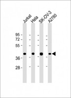 GBGT1 Antibody - All lanes: Anti-GBGT1 Antibody (Center) at 1:2000 dilution Lane 1: Jurkat whole cell lysate Lane 2: Hela whole cell lysate Lane 3: SK-OV-3 whole cell lysate Lane 4: A2780 whole cell lysate Lysates/proteins at 20 µg per lane. Secondary Goat Anti-Rabbit IgG, (H+L), Peroxidase conjugated at 1/10000 dilution. Predicted band size: 40 kDa Blocking/Dilution buffer: 5% NFDM/TBST.