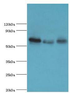 GBP1 Antibody - Western blot. All lanes: Interferon-induced guanylate-binding protein 1 antibody at 4 ug/ml. Lane 1: MM231 whole cell lysate. Lane 2: HeLa whole cell lysate. Lane 3: MGF-7 whole cell lysate. Secondary antibody: Goat polyclonal to rabbit at 1:10000 dilution. Predicted band size: 68 kDa. Observed band size: 68 kDa.