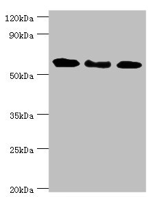 GBP1 Antibody - Western blot All lanes: Interferon-induced guanylate-binding protein 1 antibody at 4µg/ml Lane 1: MM231 whole cell lysate Lane 2: Hela whole cell lysate Lane 3: MGF-7 whole cell lysate Secondary Goat polyclonal to rabbit IgG at 1/10000 dilution Predicted band size: 68 kDa Observed band size: 68 kDa