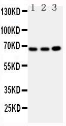 GBP1 Antibody - Anti-GBP1 antibody, Western blotting All lanes: Anti GBP1 at 0.5ug/ml Lane 1: U87 Whole Cell Lysate at 40ug Lane 2: HELA Whole Cell Lysate at 40ug Lane 3: MCF-7 Whole Cell Lysate at 40ug Predicted bind size: 68KD Observed bind size: 68KD