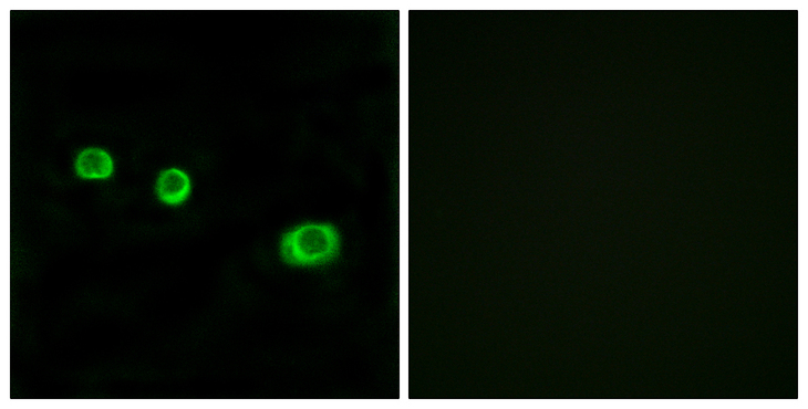 GBP1 Antibody - Immunofluorescence analysis of MCF7 cells, using GBP1 Antibody. The picture on the right is blocked with the synthesized peptide.