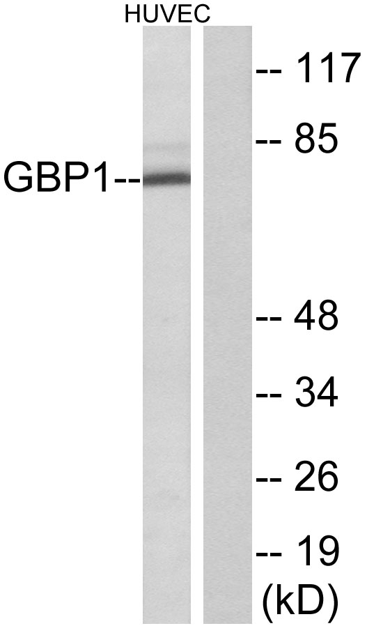 GBP1 Antibody - Western blot analysis of lysates from HUVEC cells, using GBP1 Antibody. The lane on the right is blocked with the synthesized peptide.