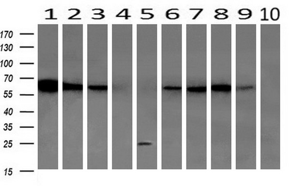GBP1 Antibody - Western blot of extracts (10ug) from 10 Human tissue by using anti-GBP1 monoclonal antibody at 1:200 (1: Testis; 2: Omentum; 3: Uterus; 4: Breast; 5: Brain; 6: Liver; 7: Ovary; 8: Thyroid gland; 9: colon;10: spleen).