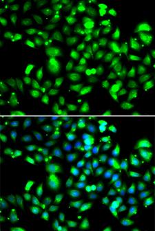 GBP1 Antibody - Immunofluorescence analysis of U20S cells.