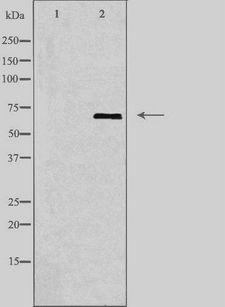 GBP1 Antibody - Western blot analysis of extracts of HuvEc cells using GBP1 antibody. The lane on the left is treated with the antigen-specific peptide.