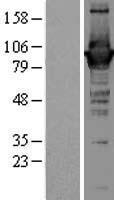 GBP1 Protein - Western validation with an anti-DDK antibody * L: Control HEK293 lysate R: Over-expression lysate