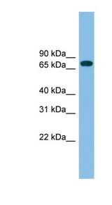 GBP2 Antibody - GBP2 antibody Western blot of Fetal Liver lysate. This image was taken for the unconjugated form of this product. Other forms have not been tested.