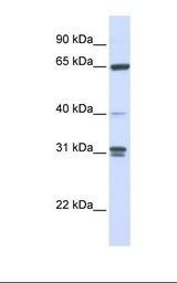 GBP2 Antibody - 721_B cell lysate. Antibody concentration: 1.0 ug/ml. Gel concentration: 12%.  This image was taken for the unconjugated form of this product. Other forms have not been tested.
