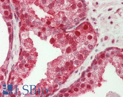 GBP2 Antibody - Human Prostate: Formalin-Fixed, Paraffin-Embedded (FFPE).  This image was taken for the unconjugated form of this product. Other forms have not been tested.