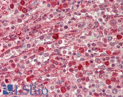 GBP2 Antibody - Human Spleen: Formalin-Fixed, Paraffin-Embedded (FFPE).  This image was taken for the unconjugated form of this product. Other forms have not been tested.