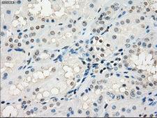 GBP2 Antibody - Immunohistochemical staining of paraffin-embedded Kidney tissue using anti-GBP2 mouse monoclonal antibody. (Dilution 1:50).