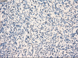 GBP2 Antibody - Immunohistochemical staining of paraffin-embedded Ovary tissue using anti-GBP2 mouse monoclonal antibody. (Dilution 1:50).
