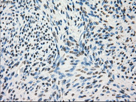 GBP2 Antibody - Immunohistochemical staining of paraffin-embedded endometrium tissue using anti-GBP2 mouse monoclonal antibody. (Dilution 1:50).