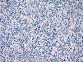 GBP2 Antibody - Immunohistochemical staining of paraffin-embedded Ovary tissue using anti-GBP2 mouse monoclonal antibody. (Dilution 1:50).