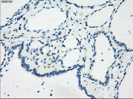 GBP2 Antibody - Immunohistochemical staining of paraffin-embedded thyroid tissue using anti-GBP2 mouse monoclonal antibody. (Dilution 1:50).