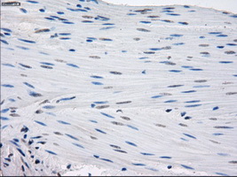 GBP2 Antibody - Immunohistochemical staining of paraffin-embedded colon tissue using anti-GBP2 mouse monoclonal antibody. (Dilution 1:50).