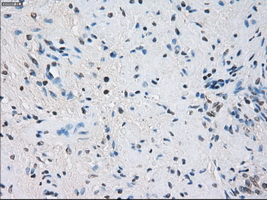 GBP2 Antibody - Immunohistochemical staining of paraffin-embedded prostate tissue using anti-GBP2 mouse monoclonal antibody. (Dilution 1:50).